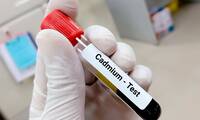 Cadmium Le dépistage bientôt remboursé, mais pas pour tous