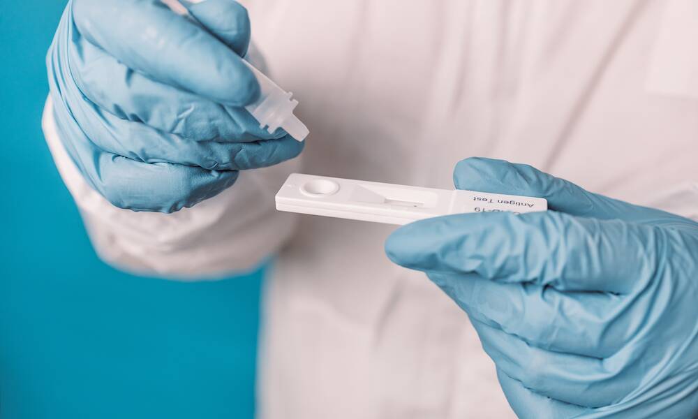 Covid-19 - Les tests rapides en pharmacie ne sont plus remboursés -  Actualité - UFC-Que Choisir