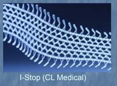 implant-i-stop-cl-medical