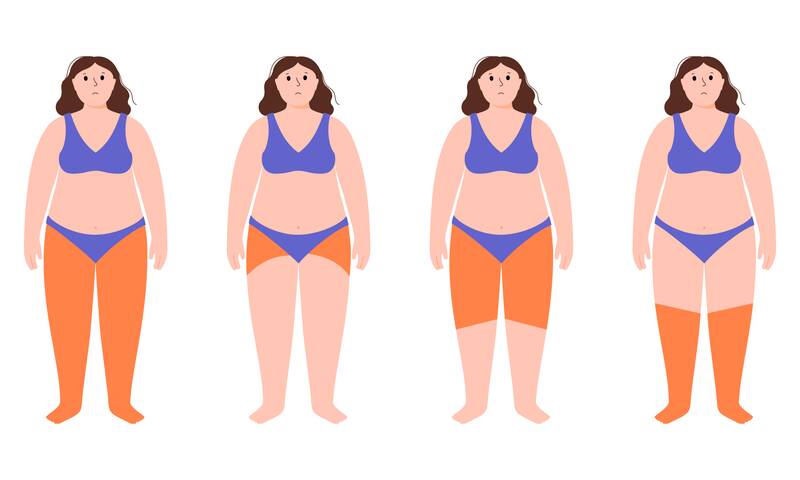 Jambes gonflées 10 questions pour tout savoir sur le lipœdème