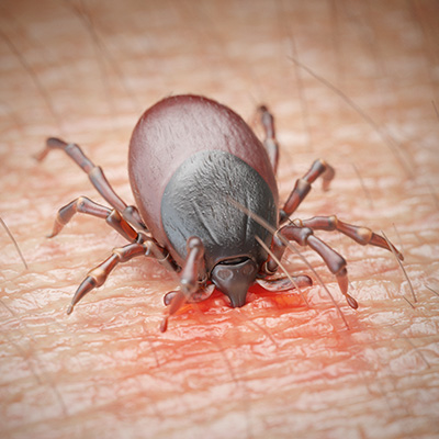 Maladie De Lyme Polemique Sur Les Centres De Reference Actualite Ufc Que Choisir