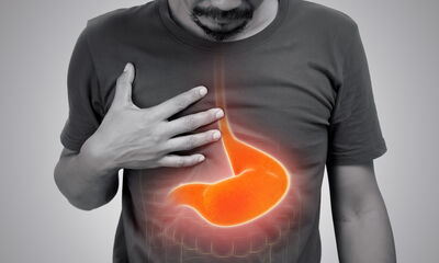 Reflux gastro-œsophagien (RGO) Que faire quand les brûlures d’estomac persistent ?