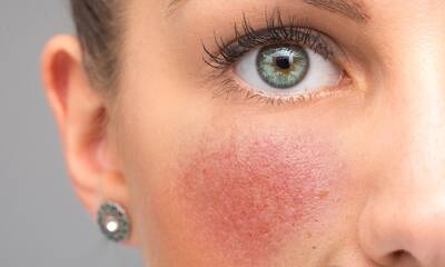 Cosmétiques Les ingrédients incompatibles avec le soleil