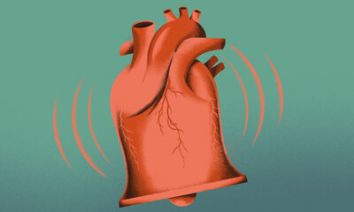 Infarctus du myocarde Comment réagir et se rétablir