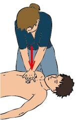 Massage cardiaque position