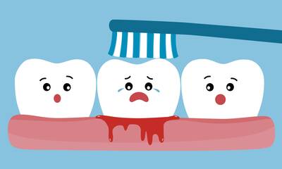 Saignement des gencives Un signe à ne pas négliger