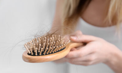 Se soigner La chute de cheveux chez les femmes