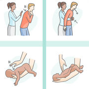 Secourisme Face à une personne qui s’étouffe