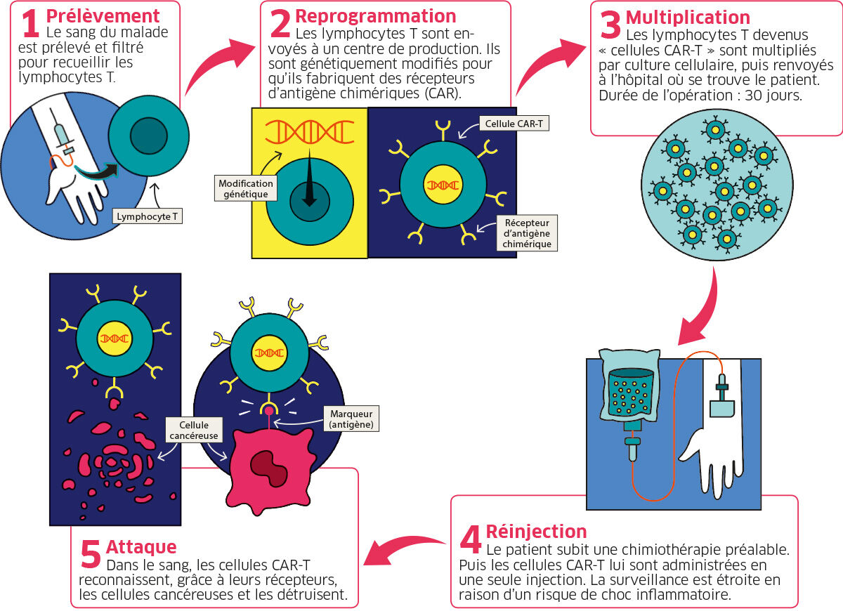 infographie cancer