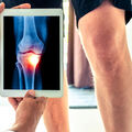 Arthrose ou arthrite ?