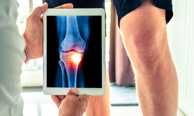 Douleurs articulaires Arthrose ou arthrite ?