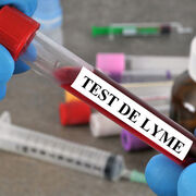 Maladie de Lyme Diagnostic : pourquoi le test fait tiquer