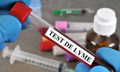 Maladie de Lyme Diagnostic : pourquoi le test fait tiquer