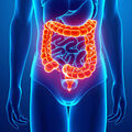 Ceux qui causent des saignements digestifs