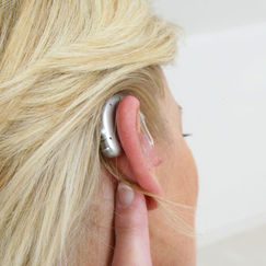Prothèses auditives 100 % remboursées et de bon ton